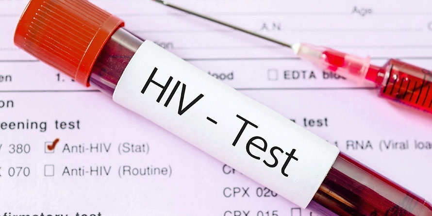 Langkah Kenya Manghadapi Pandemi HIV1